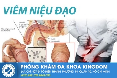 chua-tri-viem-nieu-dao-bang-cach-nao