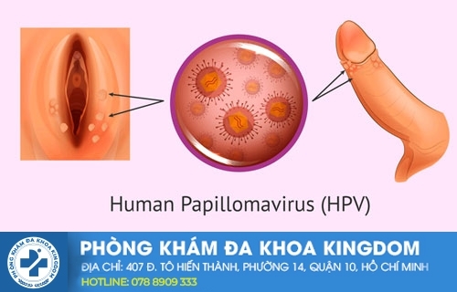 virus HPV