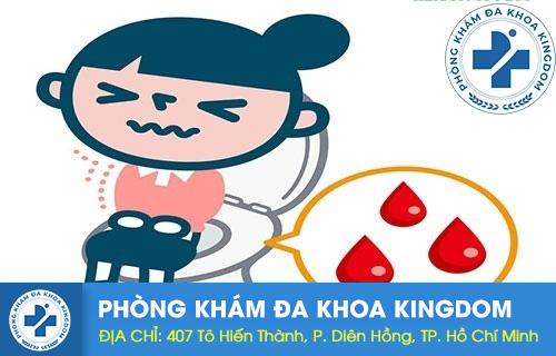Đi Cầu Ra Máu Khám Ở Đâu? Top Địa Chỉ Uy Tín & Chuyên Sâu Tại TP.HCM
